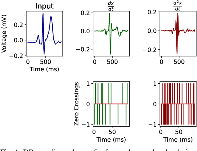 Figure 1 for Baseline Drift Tolerant Signal Encoding for ECG Classification with Deep Learning