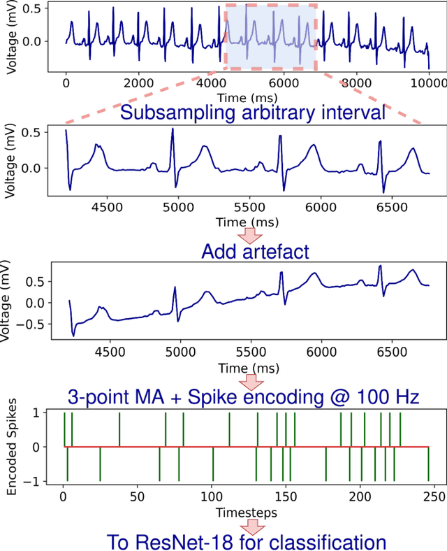 Figure 2 for Baseline Drift Tolerant Signal Encoding for ECG Classification with Deep Learning