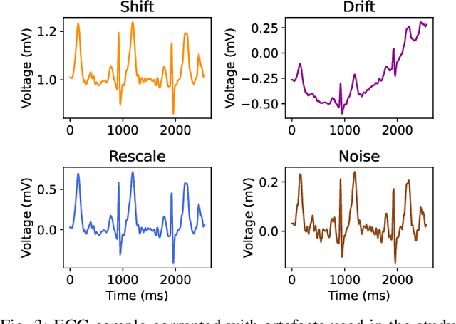 Figure 3 for Baseline Drift Tolerant Signal Encoding for ECG Classification with Deep Learning