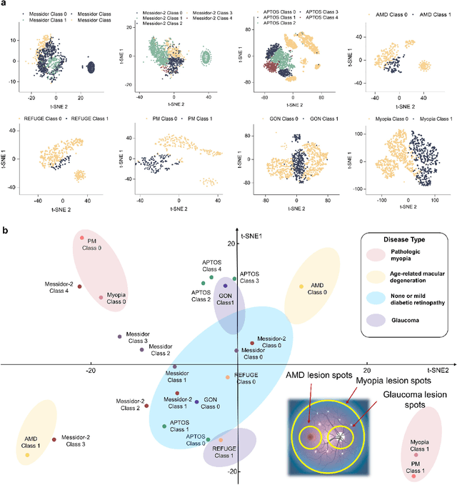 Figure 3 for Diagnosis of Multiple Fundus Disorders Amidst a Scarcity of Medical Experts Via Self-supervised Machine Learning