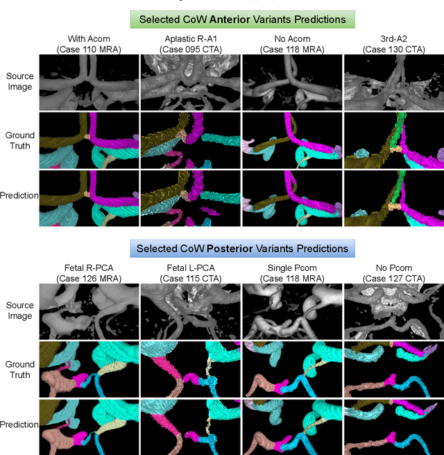 Figure 3 for Benchmarking the CoW with the TopCoW Challenge: Topology-Aware Anatomical Segmentation of the Circle of Willis for CTA and MRA