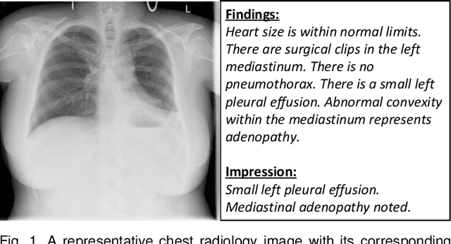 Figure 1 for A Systematic Review of Deep Learning-based Research on Radiology Report Generation