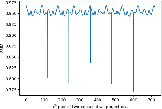 Figure 4 for MIRT: a simultaneous reconstruction and affine motion compensation technique for four dimensional computed tomography (4DCT)