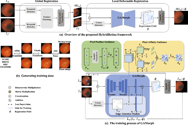 Figure 2 for Progressive Retinal Image Registration via Global and Local Deformable Transformations