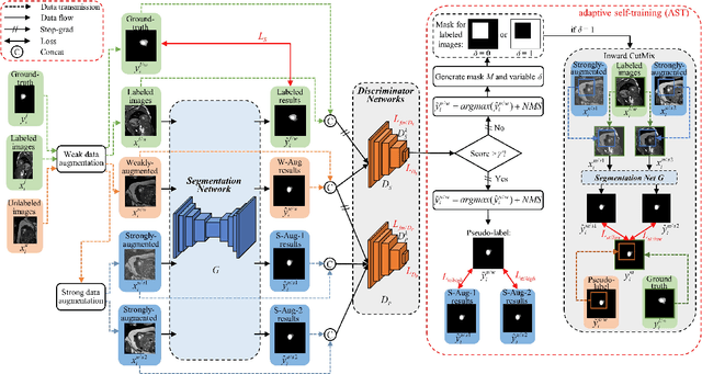 Figure 1 for AstMatch: Adversarial Self-training Consistency Framework for Semi-Supervised Medical Image Segmentation