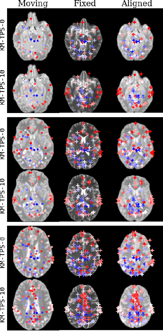 Figure 4 for A robust and interpretable deep learning framework for multi-modal registration via keypoints