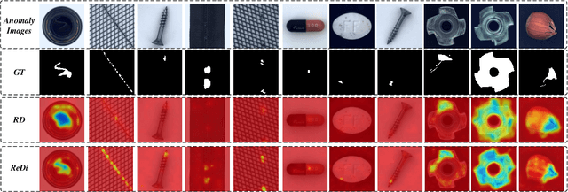 Figure 4 for A Recover-then-Discriminate Framework for Robust Anomaly Detection