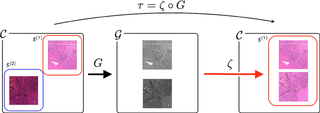 Figure 3 for Semi-supervised ViT knowledge distillation network with style transfer normalization for colorectal liver metastases survival prediction