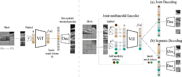 Figure 1 for Masked Image Modelling for retinal OCT understanding