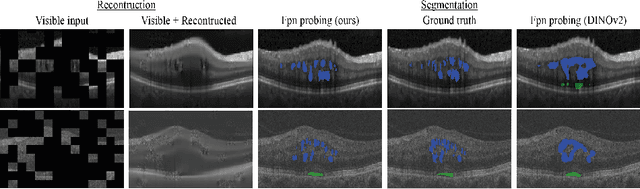Figure 3 for Masked Image Modelling for retinal OCT understanding
