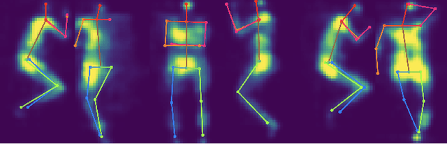 Figure 1 for In-Bed Pose Estimation: A Review