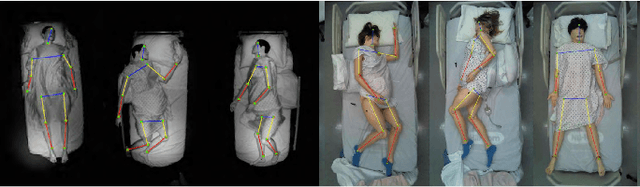 Figure 2 for In-Bed Pose Estimation: A Review