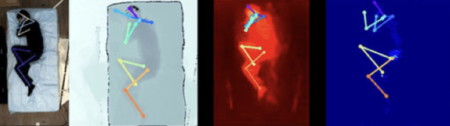 Figure 3 for In-Bed Pose Estimation: A Review