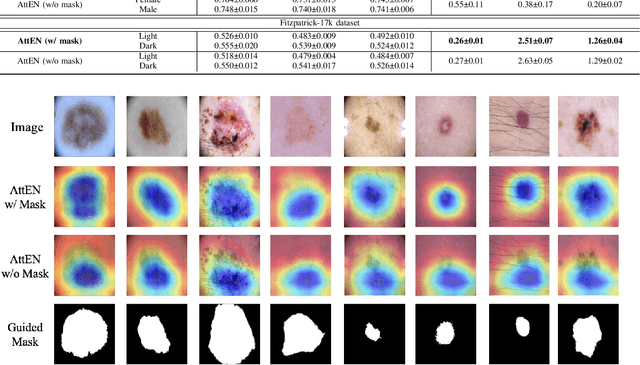 Figure 4 for Achieve Fairness without Demographics for Dermatological Disease Diagnosis