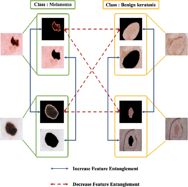 Figure 1 for Achieve Fairness without Demographics for Dermatological Disease Diagnosis