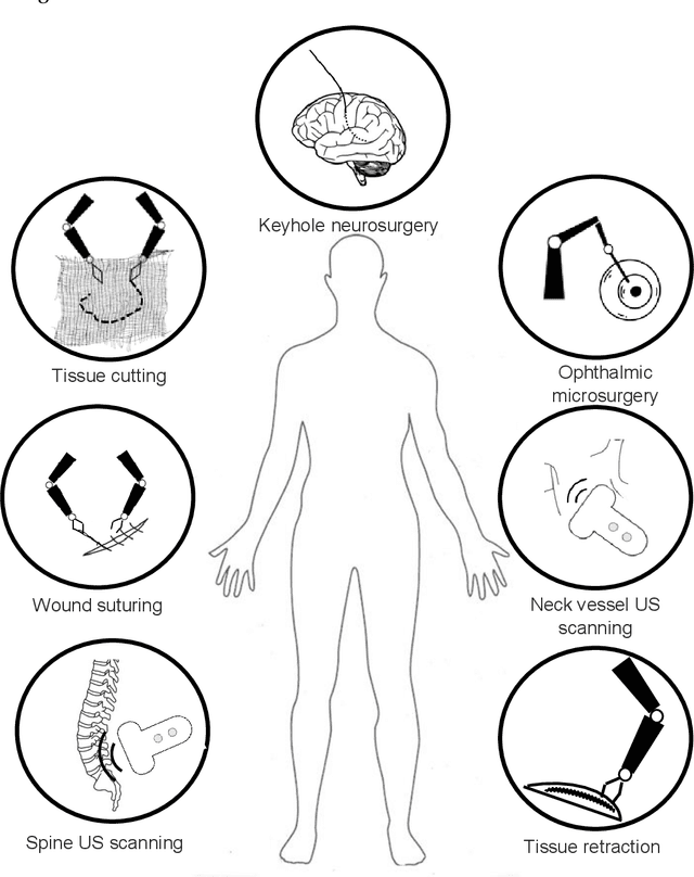 Figure 1 for Deep Reinforcement Learning in Surgical Robotics: Enhancing the Automation Level