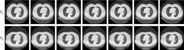 Figure 3 for A Cross Spatio-Temporal Pathology-based Lung Nodule Dataset