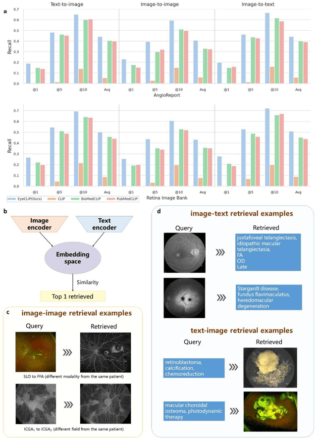 Figure 4 for EyeCLIP: A visual-language foundation model for multi-modal ophthalmic image analysis