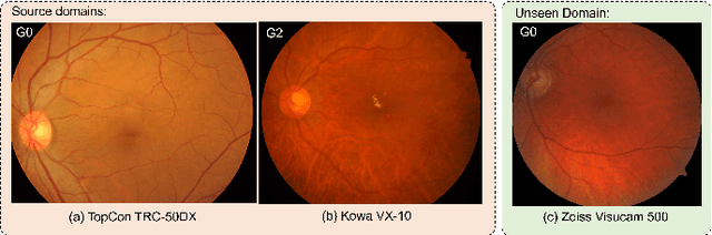 Figure 1 for CauDR: A Causality-inspired Domain Generalization Framework for Fundus-based Diabetic Retinopathy Grading