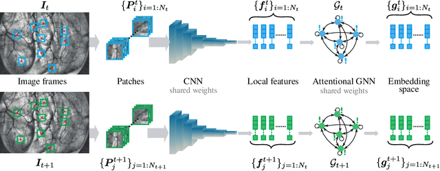 Figure 1 for Graph Self-Supervised Learning for Endoscopic Image Matching