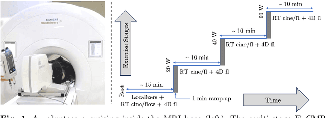 Figure 2 for Accelerated Real-time Cine and Flow under In-magnet Staged Exercise