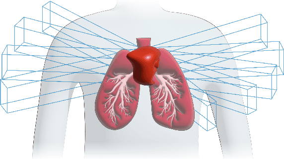 Figure 1 for SP-DiffDose: A Conditional Diffusion Model for Radiation Dose Prediction Based on Multi-Scale Fusion of Anatomical Structures, Guided by SwinTransformer and Projector