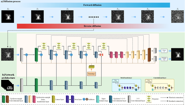 Figure 2 for SP-DiffDose: A Conditional Diffusion Model for Radiation Dose Prediction Based on Multi-Scale Fusion of Anatomical Structures, Guided by SwinTransformer and Projector