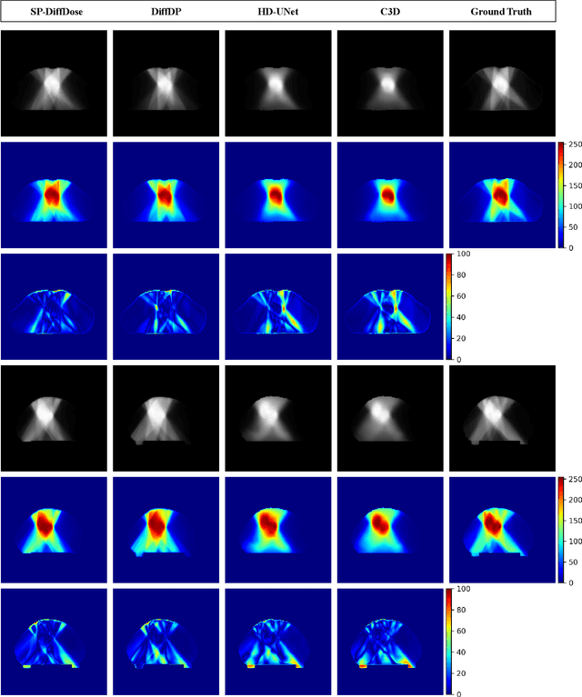 Figure 3 for SP-DiffDose: A Conditional Diffusion Model for Radiation Dose Prediction Based on Multi-Scale Fusion of Anatomical Structures, Guided by SwinTransformer and Projector