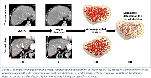 Figure 2 for A comprehensive liver CT landmark pair dataset for evaluating deformable image registration algorithms