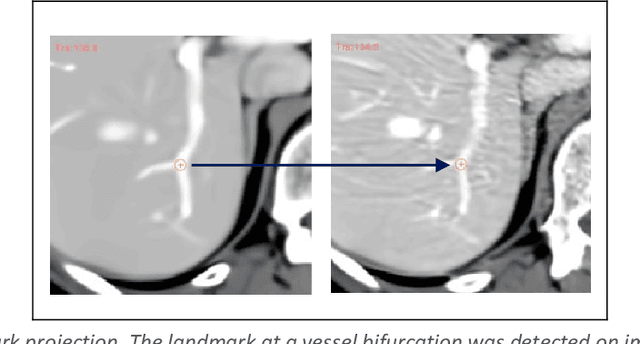 Figure 4 for A comprehensive liver CT landmark pair dataset for evaluating deformable image registration algorithms