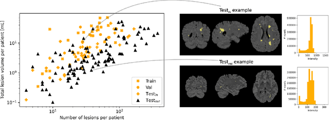 Figure 2 for Structural-Based Uncertainty in Deep Learning Across Anatomical Scales: Analysis in White Matter Lesion Segmentation