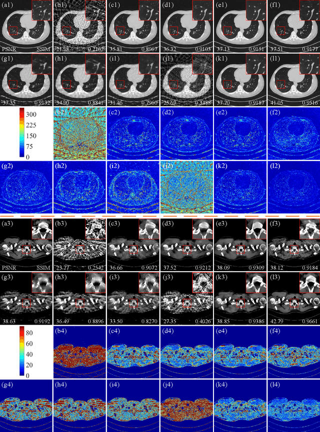 Figure 3 for MVMS-RCN: A Dual-Domain Unfolding CT Reconstruction with Multi-sparse-view and Multi-scale Refinement-correction