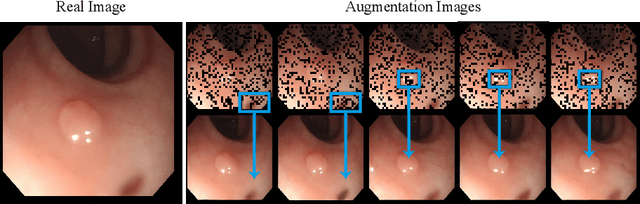 Figure 3 for Test-Time Generative Augmentation for Medical Image Segmentation