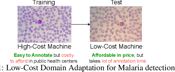 Figure 1 for CodaMal: Contrastive Domain Adaptation for Malaria Detection in Low-Cost Microscopes