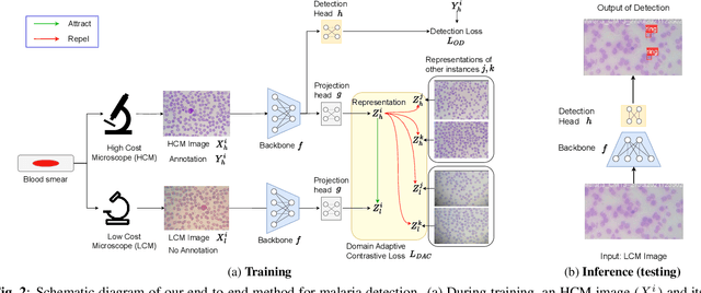 Figure 3 for CodaMal: Contrastive Domain Adaptation for Malaria Detection in Low-Cost Microscopes