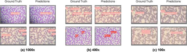 Figure 4 for CodaMal: Contrastive Domain Adaptation for Malaria Detection in Low-Cost Microscopes