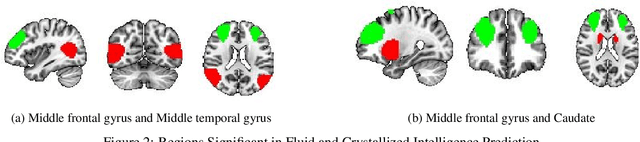 Figure 4 for Brain Networks and Intelligence: A Graph Neural Network Based Approach to Resting State fMRI Data