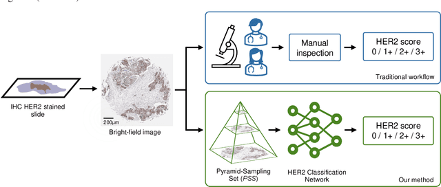 Figure 1 for Automated HER2 Scoring in Breast Cancer Images Using Deep Learning and Pyramid Sampling