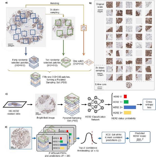 Figure 2 for Automated HER2 Scoring in Breast Cancer Images Using Deep Learning and Pyramid Sampling