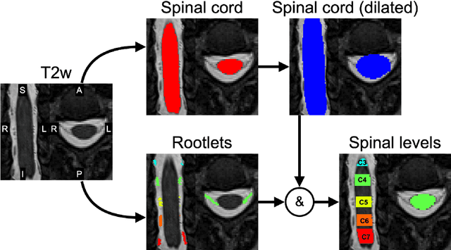 Figure 2 for Automatic Segmentation of the Spinal Cord Nerve Rootlets