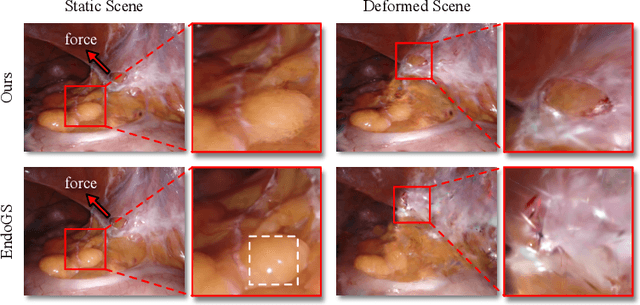 Figure 4 for Efficient Data-driven Scene Simulation using Robotic Surgery Videos via Physics-embedded 3D Gaussians