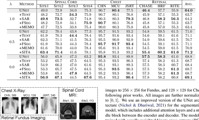 Figure 4 for Medical Image Segmentation with InTEnt: Integrated Entropy Weighting for Single Image Test-Time Adaptation