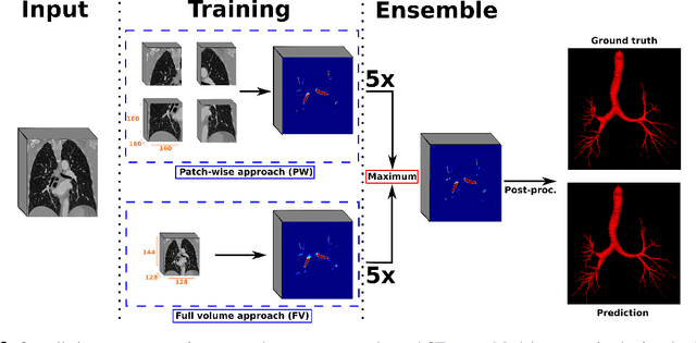 Figure 3 for AeroPath: An airway segmentation benchmark dataset with challenging pathology