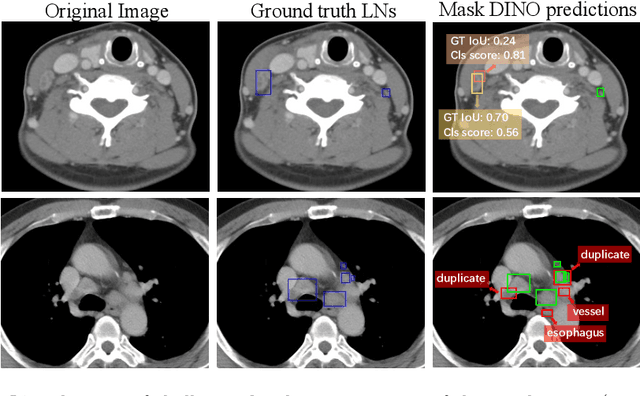 Figure 1 for Effective Lymph Nodes Detection in CT Scans Using Location Debiased Query Selection and Contrastive Query Representation in Transformer