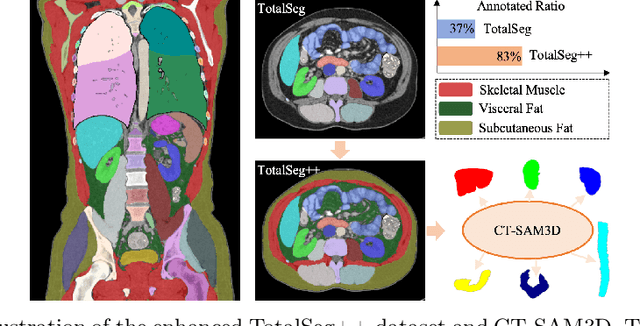 Figure 1 for Towards a Comprehensive, Efficient and Promptable Anatomic Structure Segmentation Model using 3D Whole-body CT Scans