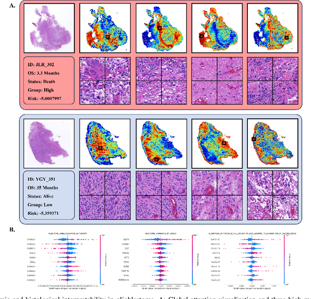 Figure 4 for Pathology-genomic fusion via biologically informed cross-modality graph learning for survival analysis