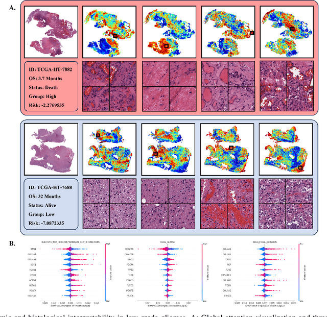 Figure 3 for Pathology-genomic fusion via biologically informed cross-modality graph learning for survival analysis