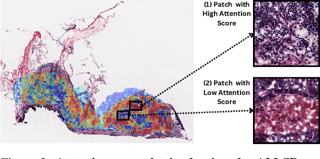 Figure 3 for Deep Learning-based Prediction of Breast Cancer Tumor and Immune Phenotypes from Histopathology