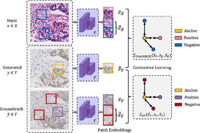 Figure 1 for Adaptive Supervised PatchNCE Loss for Learning H&E-to-IHC Stain Translation with Inconsistent Groundtruth Image Pairs