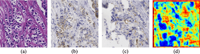 Figure 3 for Adaptive Supervised PatchNCE Loss for Learning H&E-to-IHC Stain Translation with Inconsistent Groundtruth Image Pairs